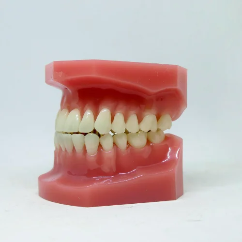 SLA dental resin model